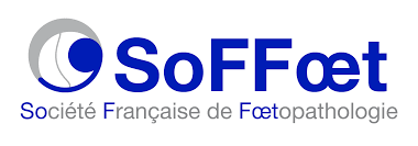 SOFFOET